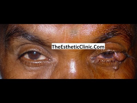 Videos from Dr. Debraj Shome