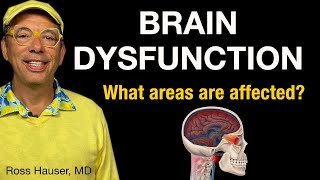 Brain dysfunction: What part of your brain is affected? Common symptoms of brain dysfunction