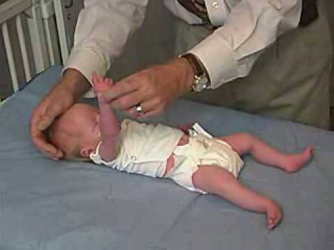 neurology exam: newborn-abnormal: Tone - Arm Traction