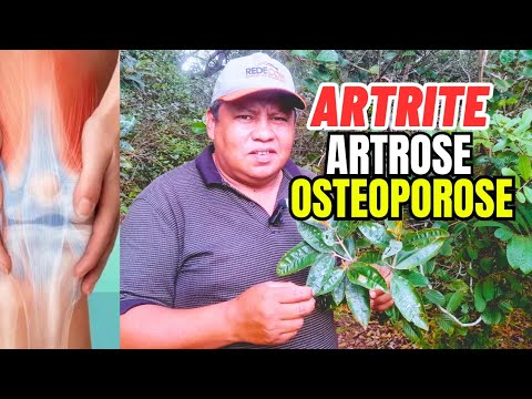 Canela de velho:Auxilia no tratamento artrite,artose,osteoporose reumatismo