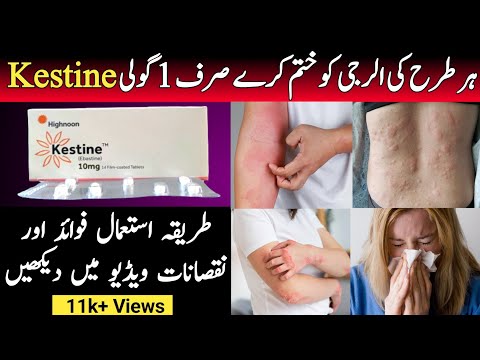 Kestine Tablet Uses In Urdu | Kestine Ebastine 10 mg