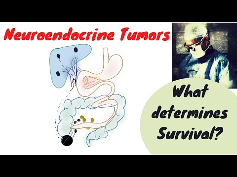 Neuroendocrine Tumors; What determines outcome?