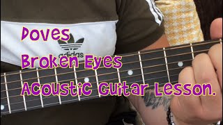 Doves-Broken Eyes-Acoustic Guitar Lesson.