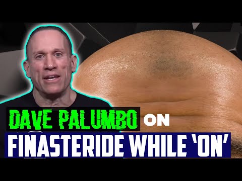 FINASTERIDE: EFFECTIVE WHILE ON CYCLE?