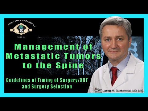 Management of Metastatic Tumors to the Spine
