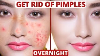 How To Get Rid of Pimples / Acne Overnight | GUARANTEED Acne Treatment at Home