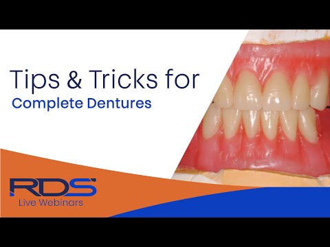 Tips and tricks complete dentures