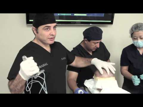 download lagu mp3 mp4 Hair Transplant Ottawa, download lagu Hair Transplant Ottawa gratis, unduh video klip Hair Transplant Ottawa
