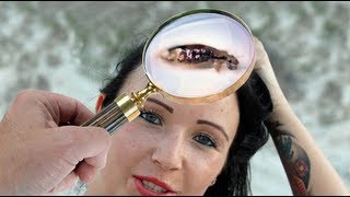 How to Remove Head Lice Eggs - Lice Treatment At Home