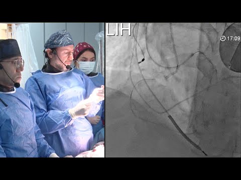 16th Experts Live CTO: LIVE CASE 4 – EuroCTO 2024