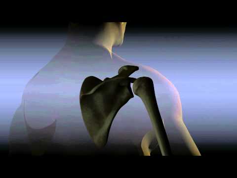 Subacromial Shoulder Injections