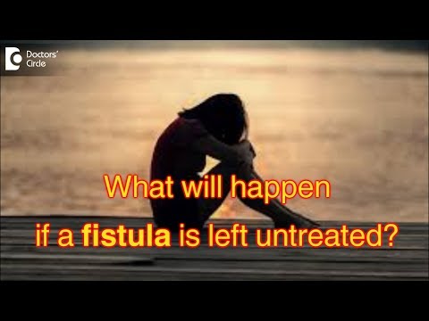 What will happen if a fistula is left untreated? - Dr. Rajasekhar M R