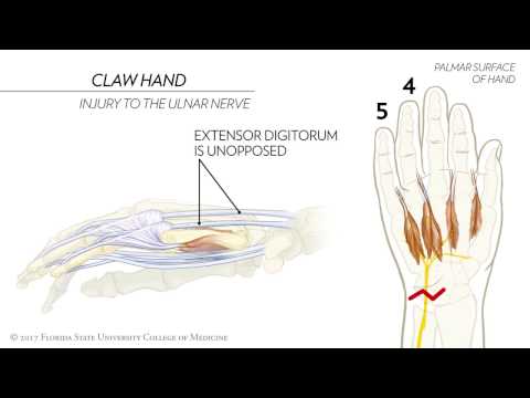 Claw Hand, Ape Hand, and the Sign of Benediction: Animated Review