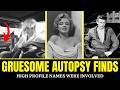 Gruesome AUTOPSY Reports Of 15 Golden Age Celebrities