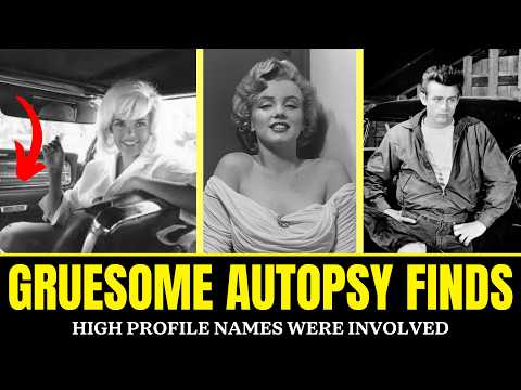 Celebrity Postmortem Photos