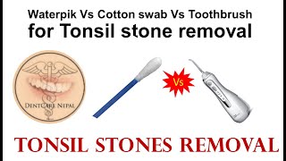 Waterpik Vs Cotton swabs Vs Toothbrush for Tonsil stone removal at Home