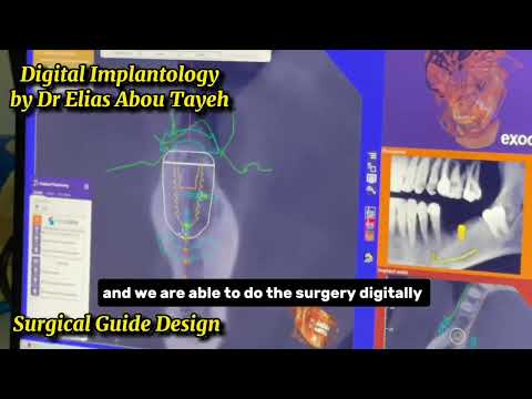 Get to know our approach with Dr. Elias