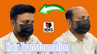 Hair Patch For Men | Hair Patch Center In Delhi | Formal Hair Style In Patch | 9599858612