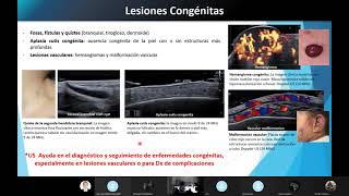 Ecografía de PIEL. Parte 1