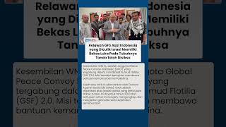 Dokter Ungkap Tanda Penyiksaan 9 WNI yang Diculik Israel Sebelum Akhirnya Dipulangkan!