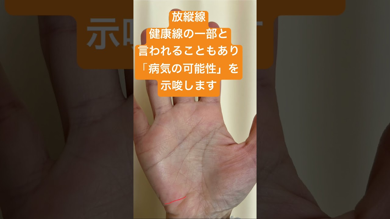 病気の可能性の放縦線 #手相 #病気 #自由