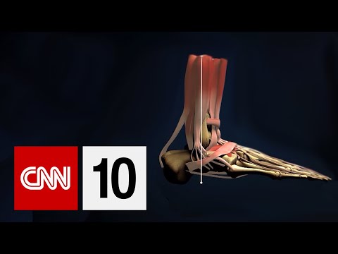 What Happens To Your Body In Space?