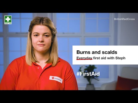 Burns and scalds: First aid steps and key action