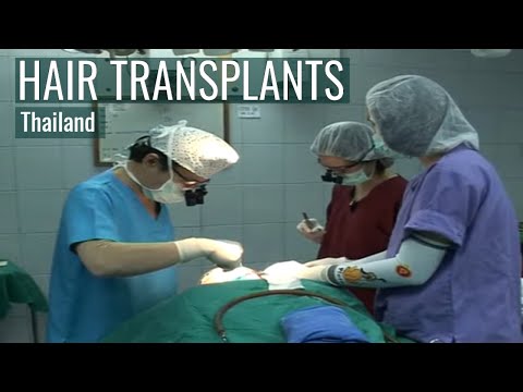 World Class Hair Transplants in Thailand
