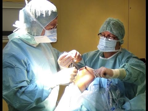 Taping in Coxarthrose Hüfte Zervikale Osteochondrose pulsierendes Geräusch im Ohr