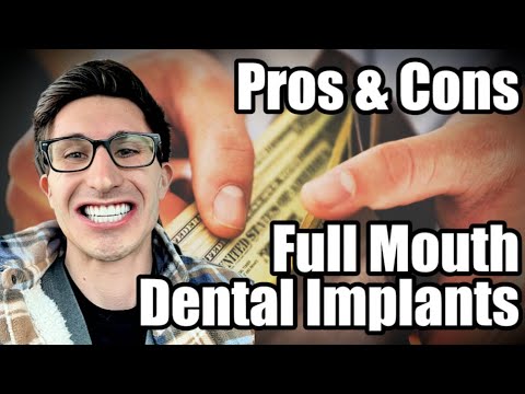 All on 4 Dental Implants - My Story - HOW MUCH THEY REALLY COST! 