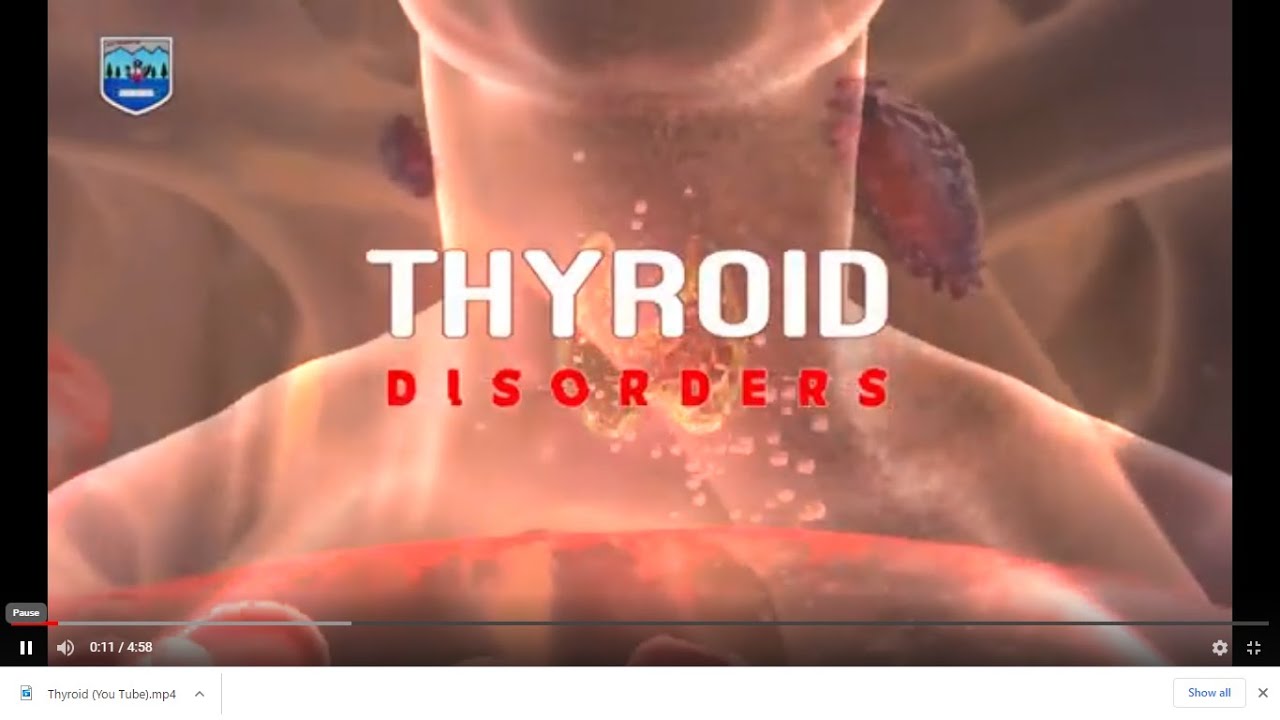 Thyroid Diseases, Kashealth production in Kashmiri/ کشمیری/ كٲشُر/ कश्मीरी