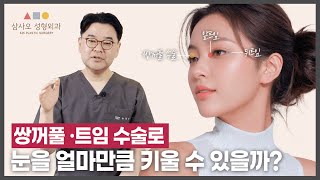 눈이 작은 꼬막 눈들 주목! 큰 눈을 만드는 수술 방법이 있습니다!_[삼사오 성형외과]