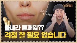 울쎄라 리프팅 부작용 '볼패임', 과연 왜 생길까? 울쎄라 부작용 볼패임 해결방법!