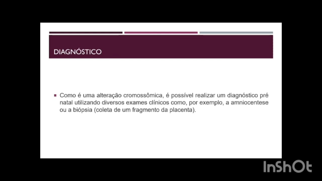 # Fisio na Síndrome de Down - Série trabalhos dos meus alunos - 07.09.2024