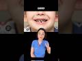 Why treat cavities in BABY teeth🐣