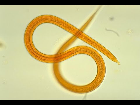 Protozoa emberi üreg paraziták