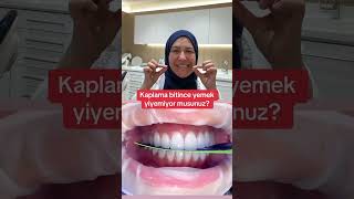 Dişler kapanışta mı? #dentist #smiledesigndental #veneer#oklüzyon