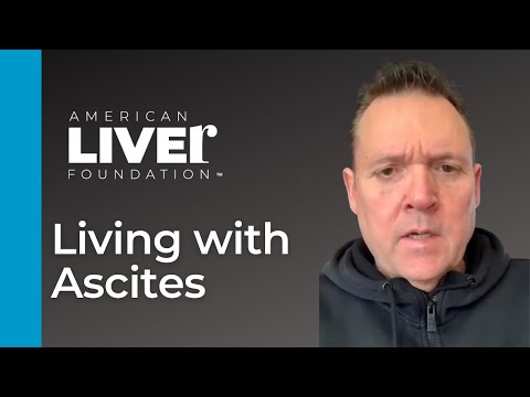 Kenneth's Experience Living with Ascites