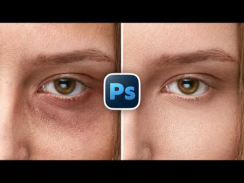 Remove Eye Bags with High-End Retouch in Photoshop
