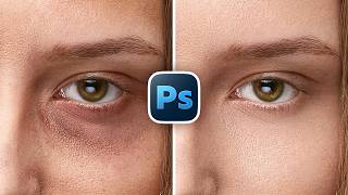 Remove Eye Bags with High-End Retouch in Photoshop