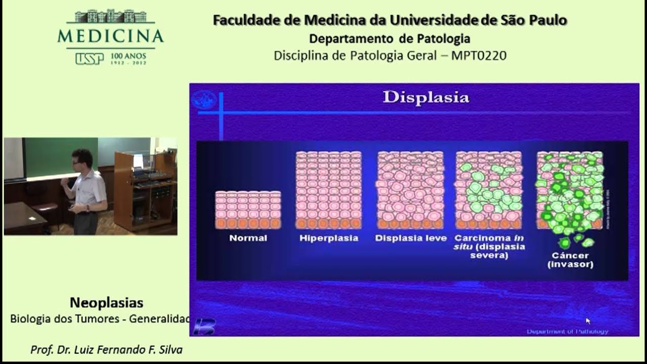 Neoplasia   Biologia dos Tumores