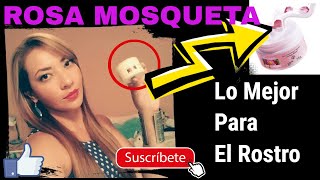Crema Rosa Mosqueta Para La Cara, Rosa Mosqueta Para Que Sirve, Rosa Mosqueta