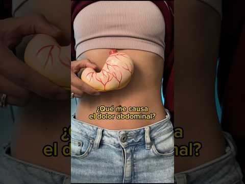What causes my abdominal pain? | Dr. William Guerrero #medicine #shorts