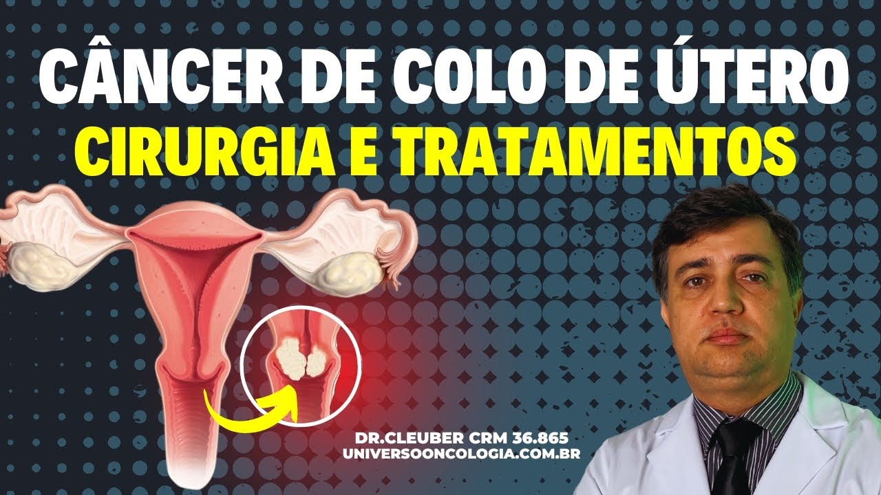 Câncer de Colo de Útero: Cirurgia e Tratamentos