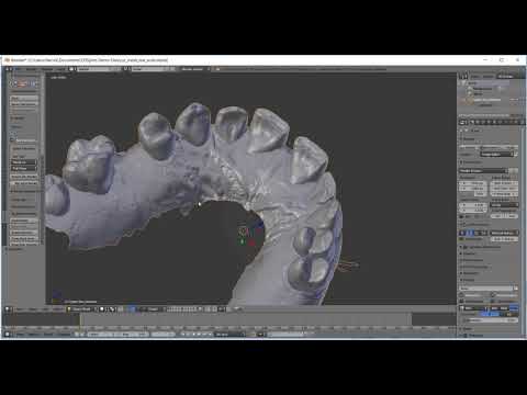 New Polytrim Datastructure