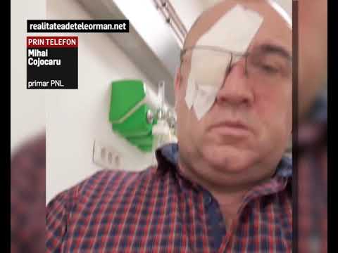 Bataie intre un primar si un consilier local în Teleorman