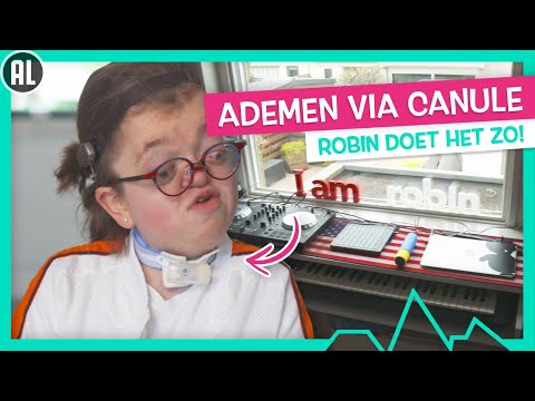 ROBIN HEEFT HET SYNDROOM VAN PFEIFFER - TOPDOKS NET FF ANDERS