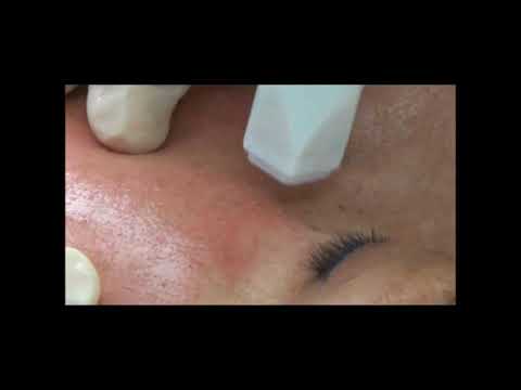 Fraxx Skin Rejuvenation