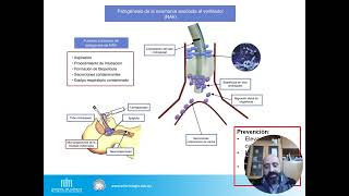 Infecciones asociadas a la asistencia sanitaria