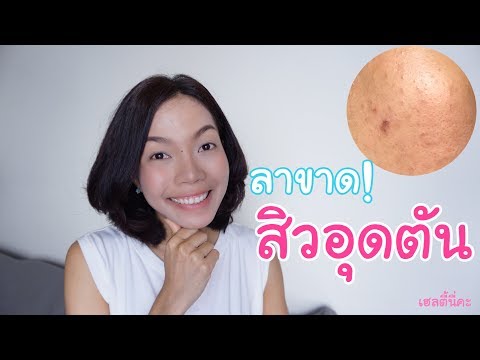 เพิ่มอวัยวะเพศชายโดยไม่ต้องผ่าตัด ฉันต้องการความแข็งแรงดี